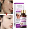 Sadoer Nicotinamide Lighten Freckles Essence Whitening Face Serum 30ml SD80168