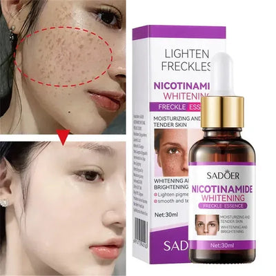 Sadoer Nicotinamide Lighten Freckles Essence Whitening Face Serum 30ml SD80168