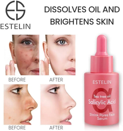 ESTELIN Tea Tree Oil Salicylic Acid Serum