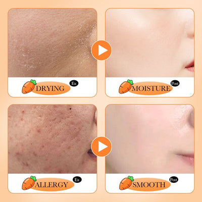 SADOER Natural Carrot & Moisturizing Facial Serum Skin Care 30ml