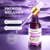 Sadoer Nicotinamide Lighten Freckles Serum 30ml sd45163