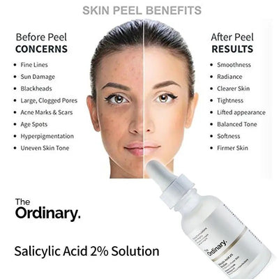 The Ordinary Salicylic Acid 2% Solution 30ml