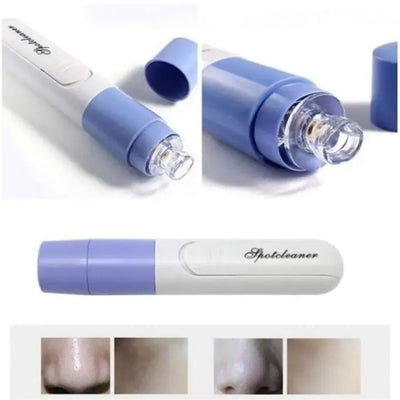 New Electric Blackhead Remover Sucker Black Head Pimple Pore Cleaner Vacuum Blackhead Remover Pore Cleaner (Random color)(H)