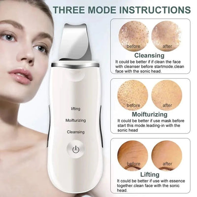 Rechargeable Ultrasonic Skin Scrubber – Deep Cleansing Facial Spatula & Blackhead Remover with Vibration & Peeling Modes(H)