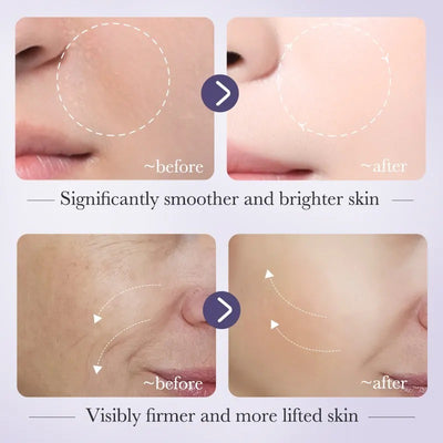 Bioaqua Retinol Serum Anti Wrinkle Fade Dark Spots Facial Serum Whiten Face Skincare Essence For Girls And Women 30ml