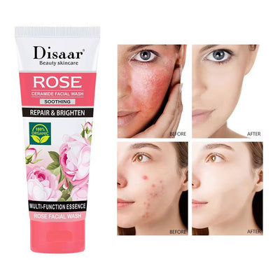 DISAAR Rose & Ceramide Facial Wash – Organic Rose Cleanser – Acne Control, Brightening & Skin Barrier Repair – Oil Control Face Wash