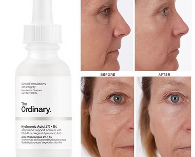 The Ordinary Hyaluronic Acid Serum 2% + B5 30Ml