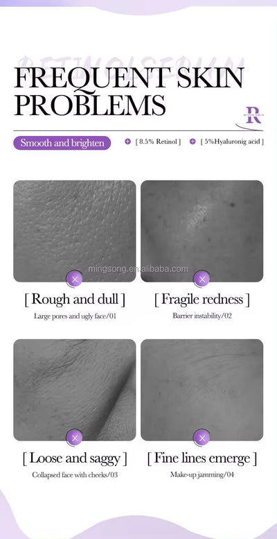 Bioaqua Retinol Serum Anti Wrinkle Fade Dark Spots Facial Serum Whiten Face Skincare Essence For Girls And Women 30ml