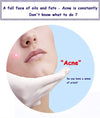 Bioaqua Acne Removal & Acne Serum Solution. Bqy57621