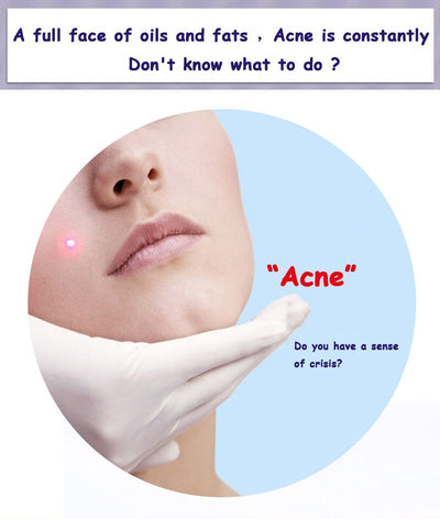 Bioaqua Acne Removal & Acne Serum Solution. Bqy57621