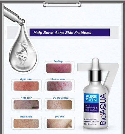 Bioaqua Acne Removal & Acne Serum Solution. Bqy57621