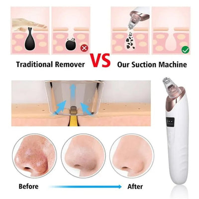 Face Vacuum Suction Blackhead Remover Pore Cleaner | Electric Deep Cleansing Tool for Nose & Face(H)